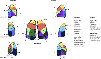 Robotic segmentectomy for early-stage lung cancer